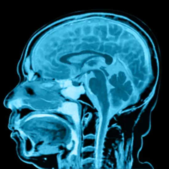 MRI Brain+Face Plain